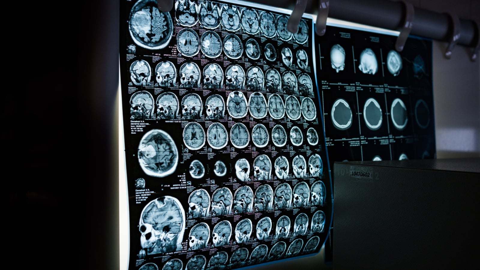 <span></span><span></span><span style="white-space: pre-wrap;">Traumatic brain injuries</span>